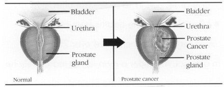 Prostate